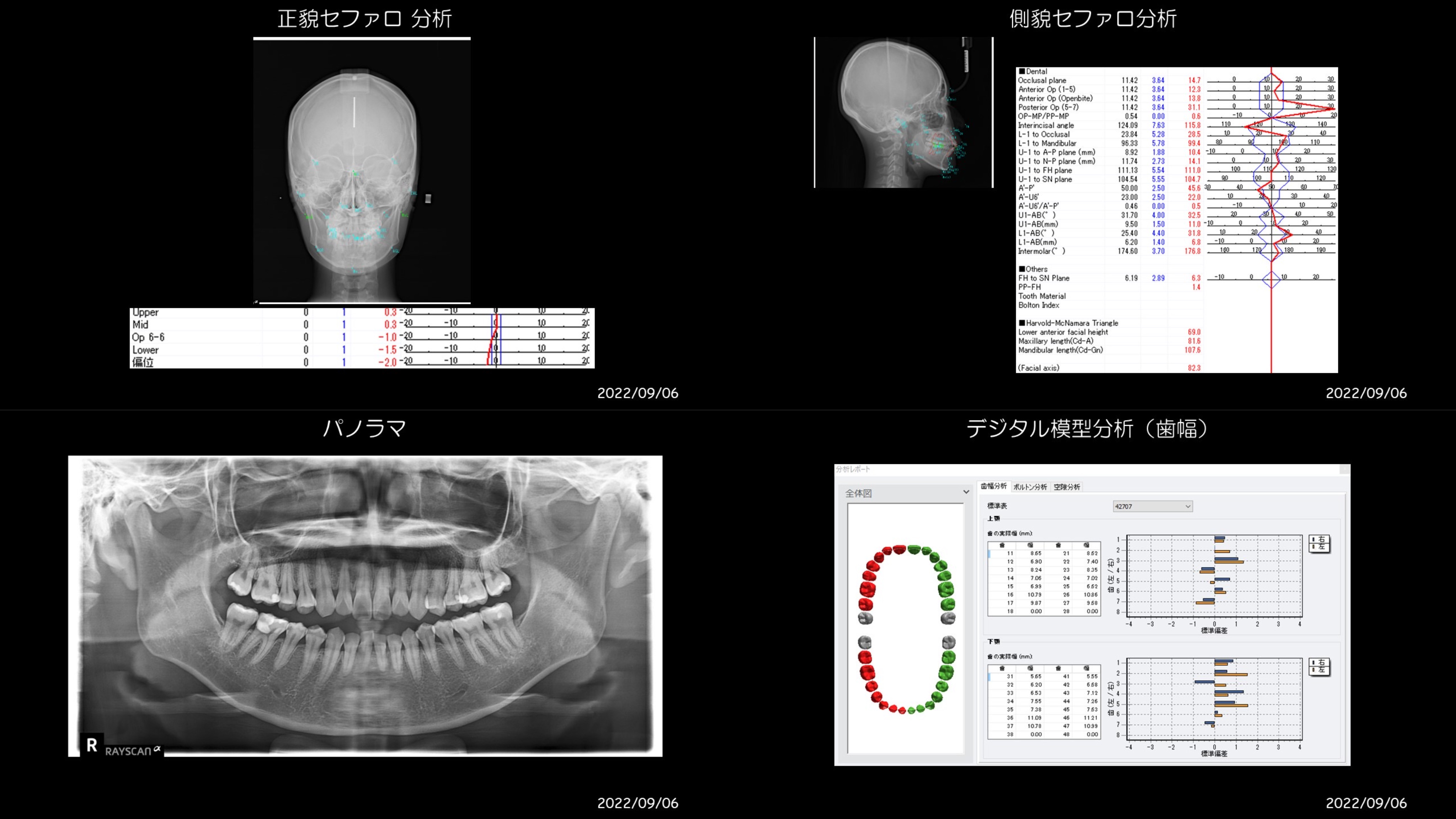 CAE9EB2A-9F4B-4366-B208-CB46BBC50560.jpeg